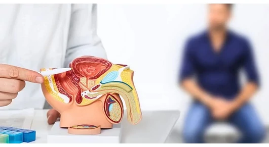 Mi a teendő jóindulatú prosztata-megnagyobbodás esetén?